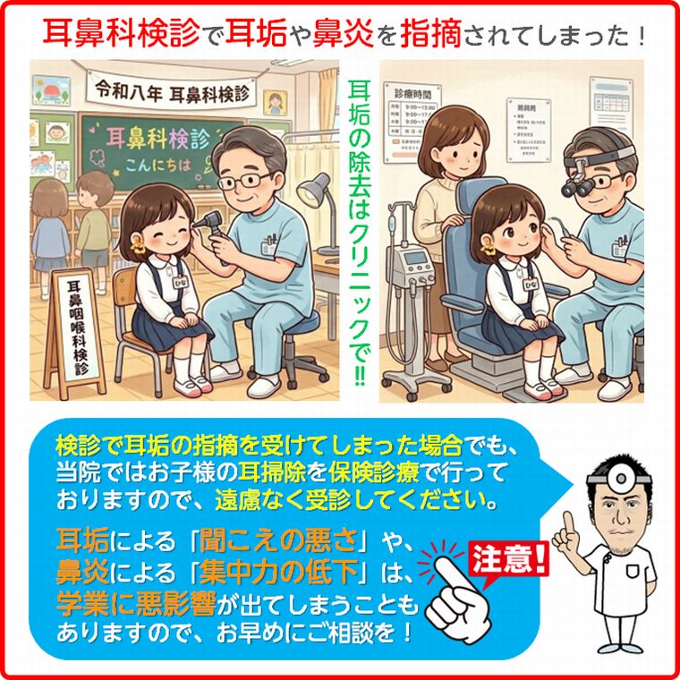 耳鼻科検診で耳垢を指摘されてしまったら